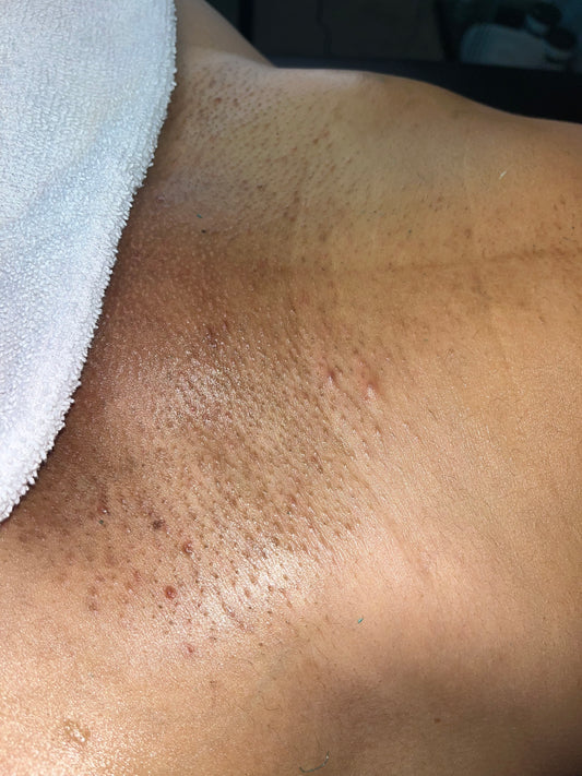 Vajacial with Brazilian Waxing in Katy, Tx