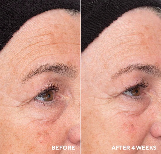 Hydropeptide's Liquid Resurfacing Solution