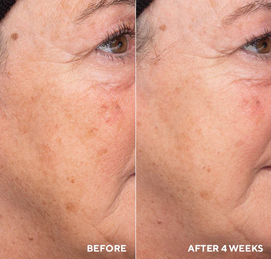 Hydropeptide's Liquid Resurfacing Solution