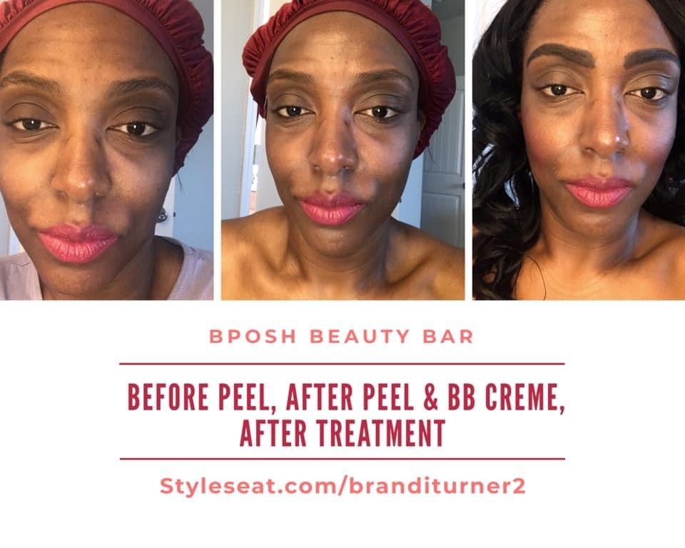 Lira Clinical BB Creme Noir 30 SPF