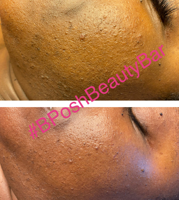 Lira Clinical MYSTIQ Infused C Serum
