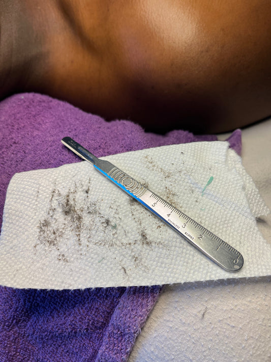 Dermaplaning Facial with Enzyme Peel Treatment