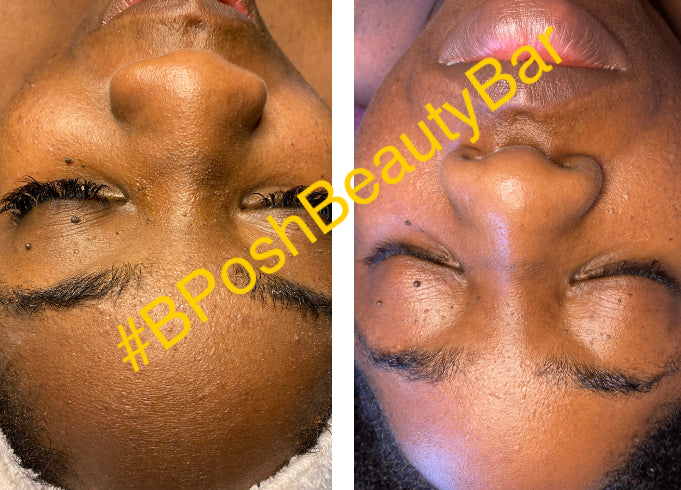 Lira Clinical MYSTIQ Infused C Serum