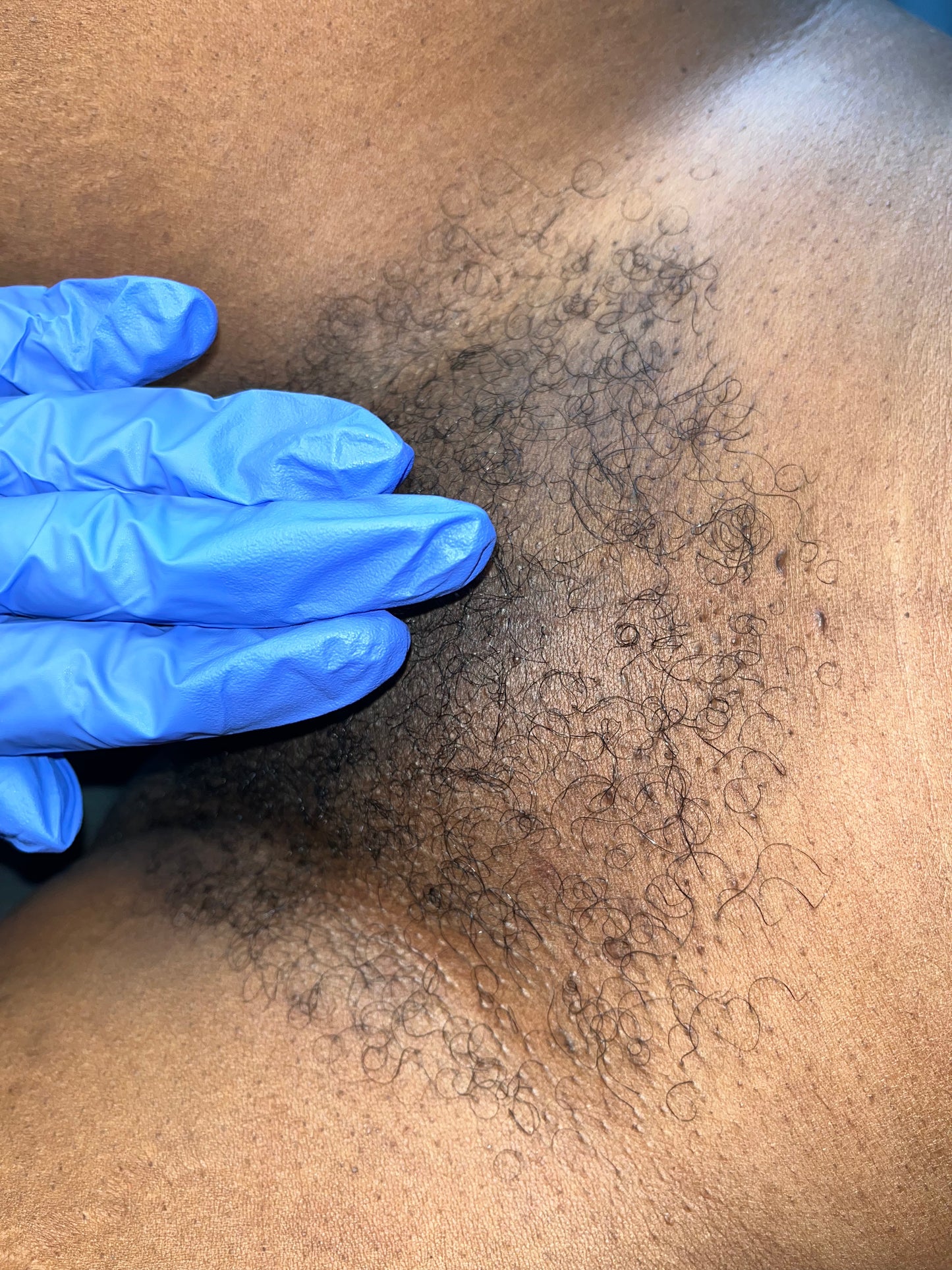 Brazilian Wax