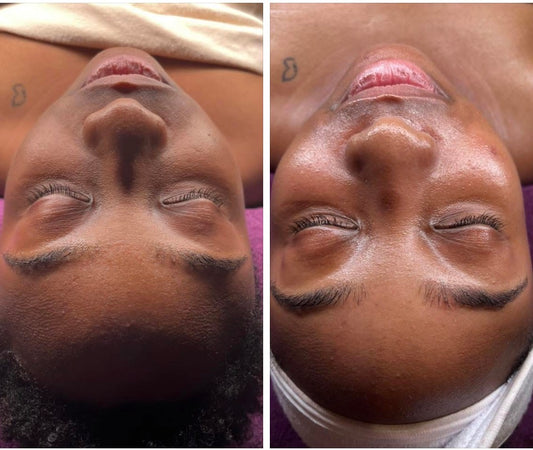 Hydrating & Brightening Facial