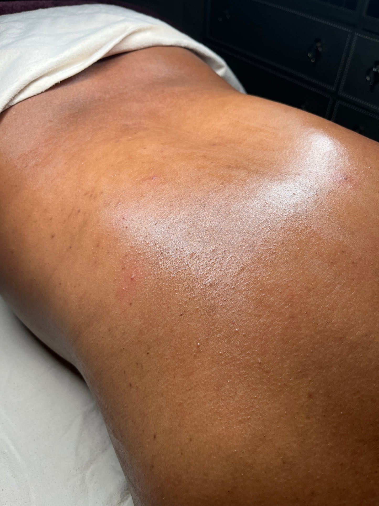 Back Facial Treatment