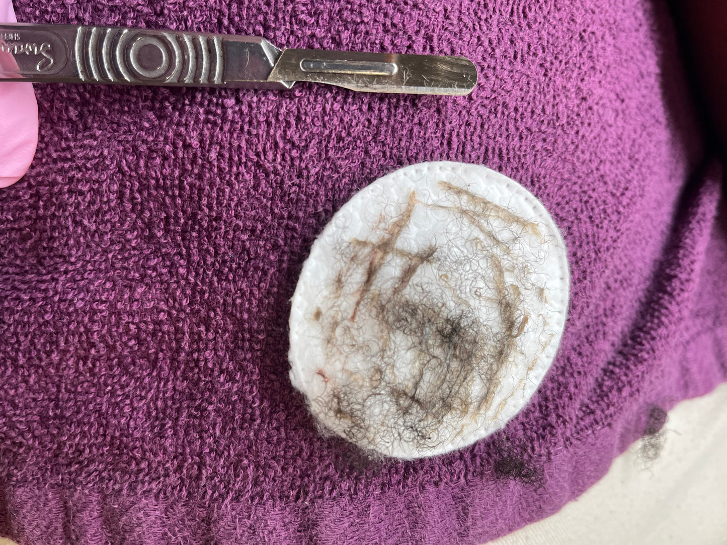 Dermaplaning Facial with Enzyme Peel Treatment