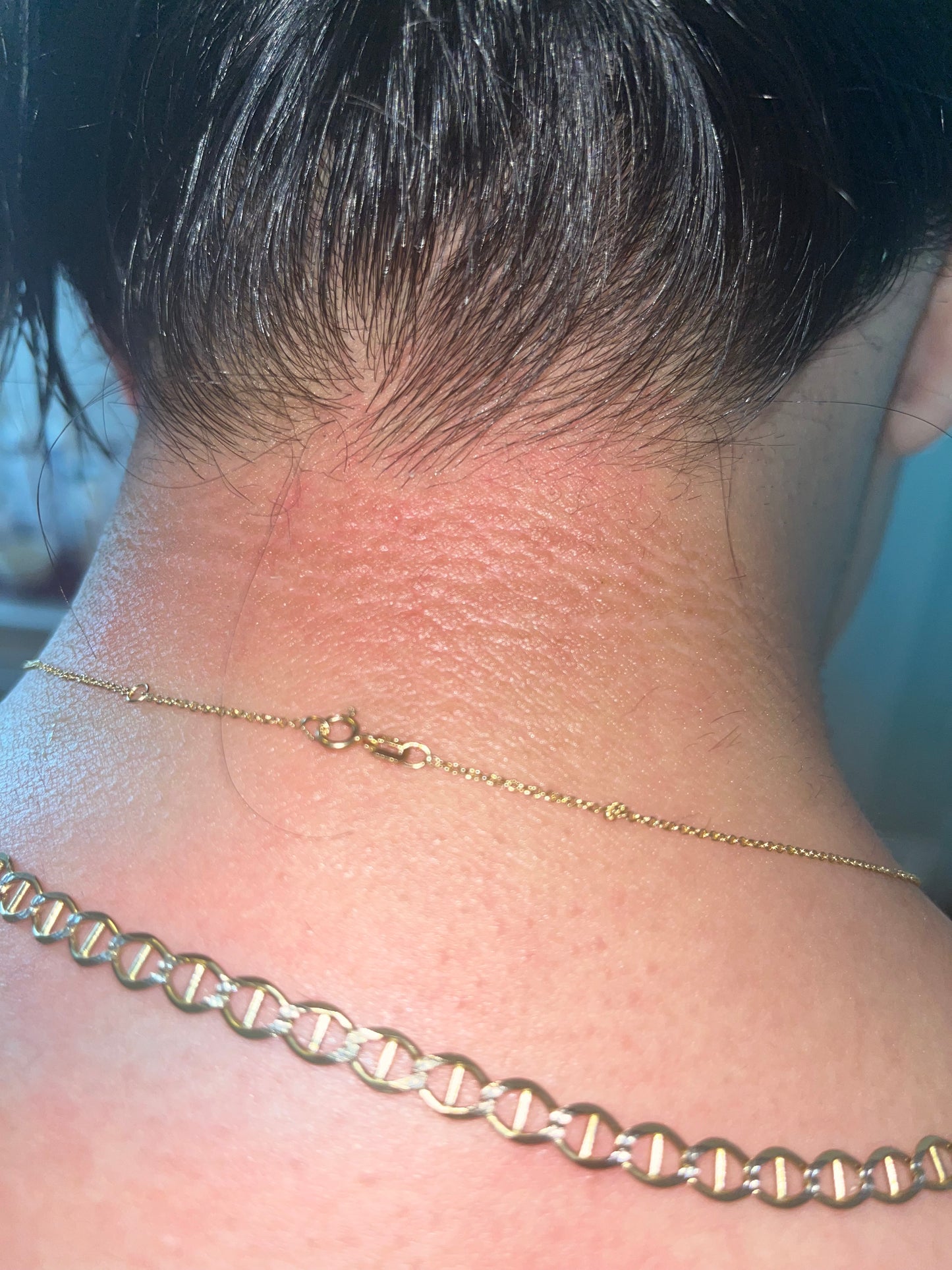Chin and Neck Waxing
