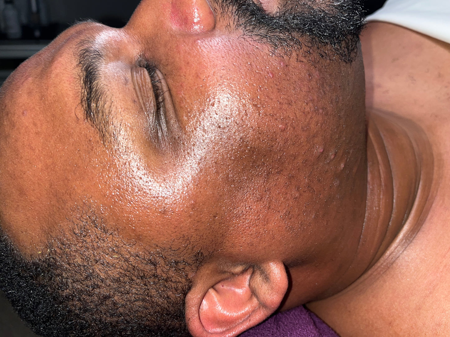 Chin and Neck Waxing