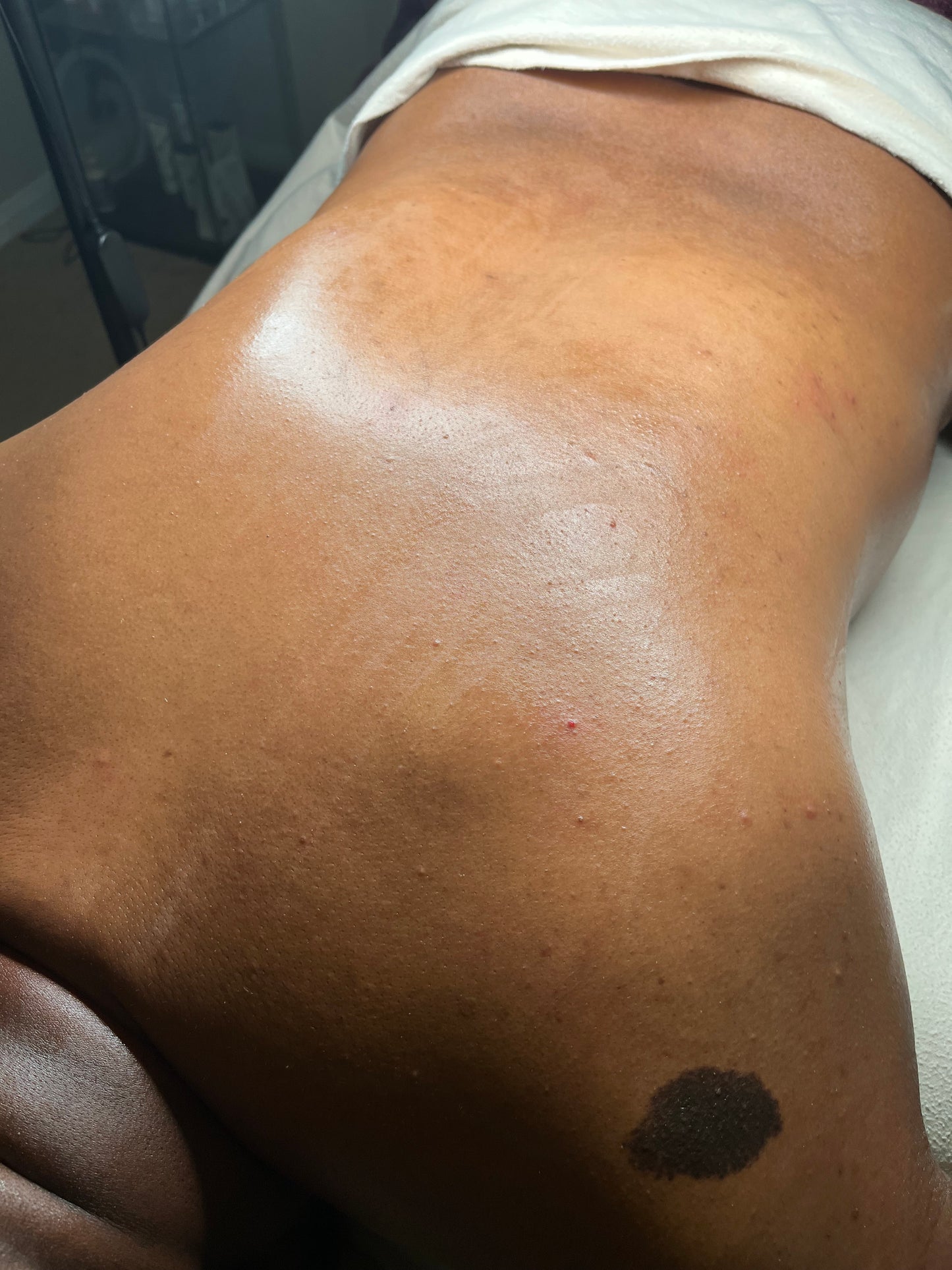 Back Facial Treatment