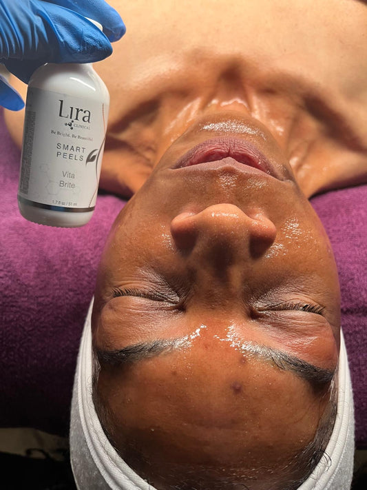 Chemical Peel Treatment