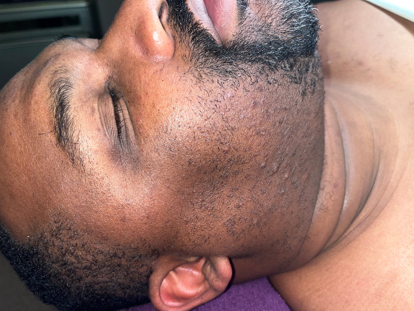 Chin and Neck Waxing