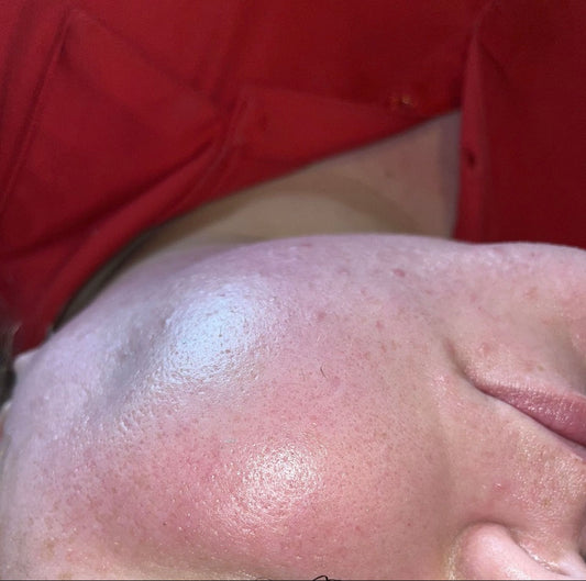 Chin Waxing